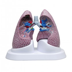 Patologický model plic