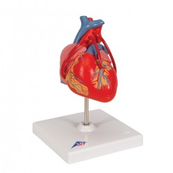 Model srdce s přemostěním (bypassem) - 2 části